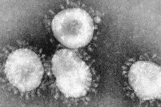 V USA se objevil první případ nákazy nebezpečným virem MERS