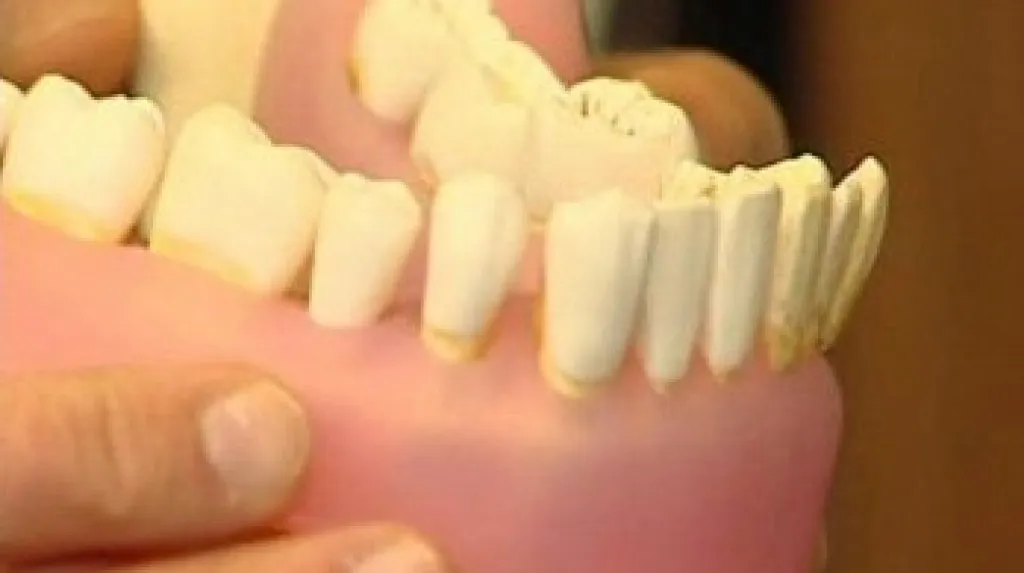 Model spodní čelisti