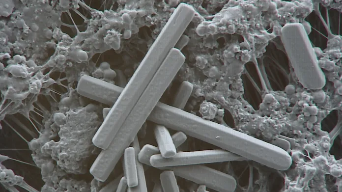 Prachová částice velikosti 5 mikrometrů s krystaly síranu vápenatého