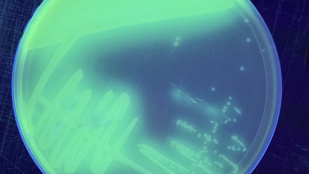 Bakterie Pseudomonas