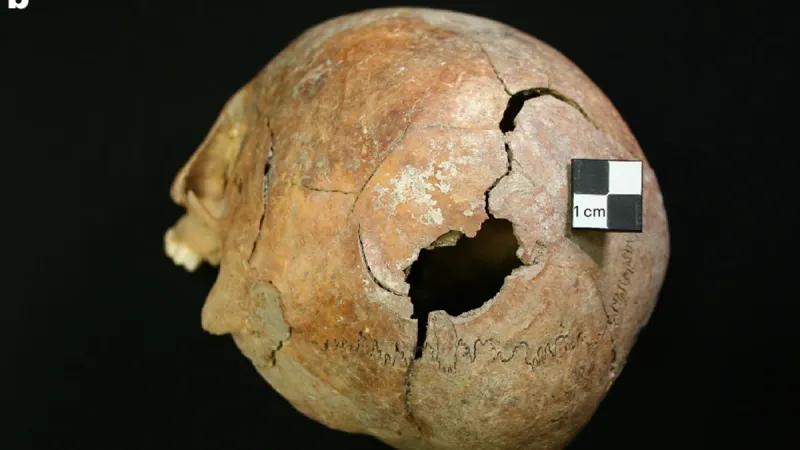 Stopy na lebkách lidských těl jasně ukazují na značnou míru násilí