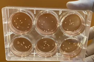 Vědci vytvořili miniaturní lidské mozečky, které mají Parkinsonovu nemoc