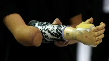 Moderní protetická ruka