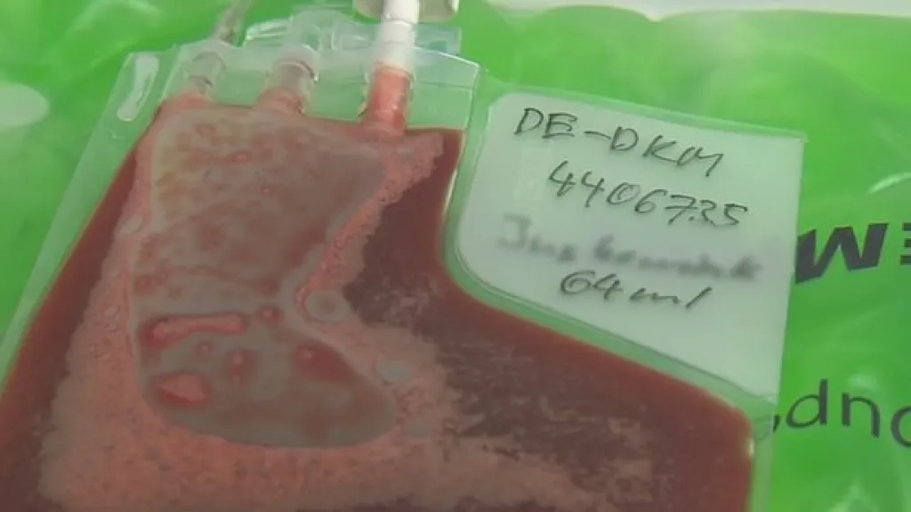 Pupečníkovou krev je možné odebrat z pupečníku i placenty