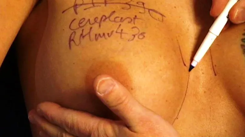 Plastická chirurgie