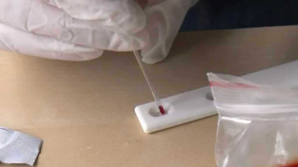 Půl roku se testují drogově závislí na AIDS a žloutenku. Z kapky krve, přímo na ulici
