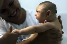 Konec pochybností: Zika poškozuje mozky lidských plodů