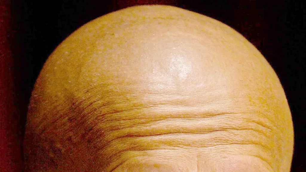 Ilustrační foto