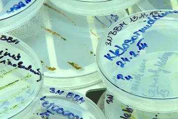 Brněnští vědci umí otravu metanolem zjistit během několika minut