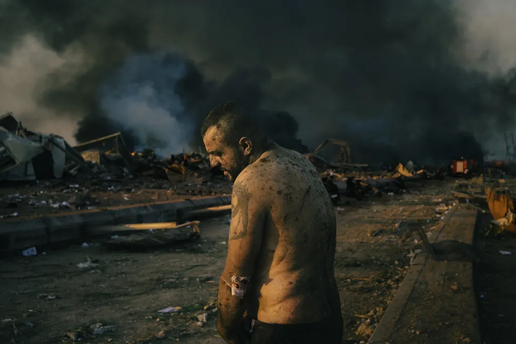 Třetí místo v kategorii Dokument: Lorenzo Tugnoli se sérií snímků nazvanou Výbuch v bejrútském přístavu