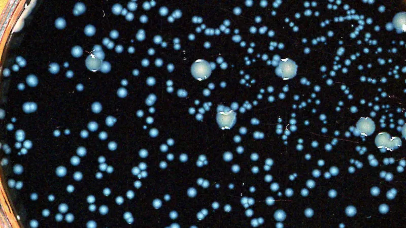 Bakterie Legionella pneumophilia