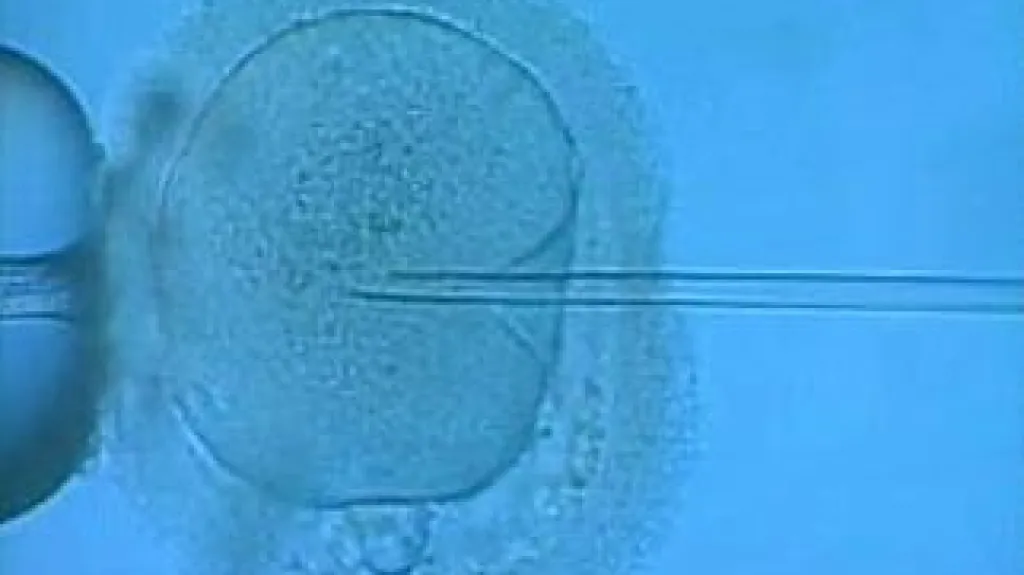 Embryo