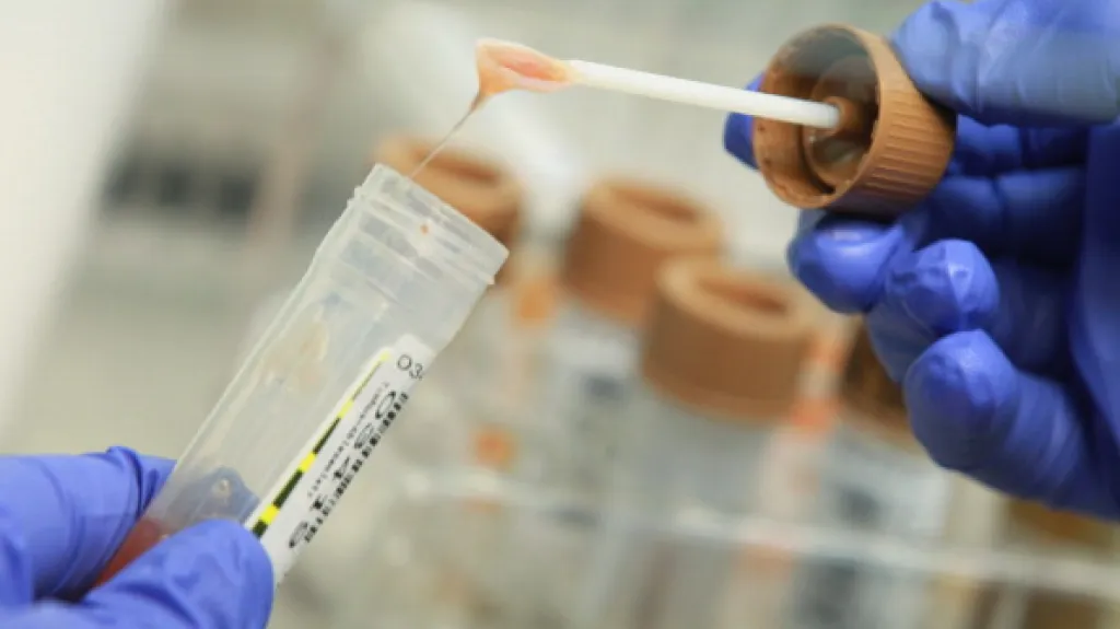 Mikrobiologická analýza