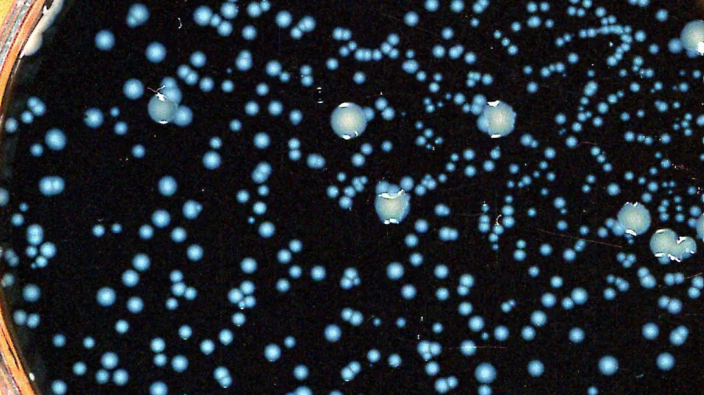 Legionella pneumophila způsobující legionářskou nemoc