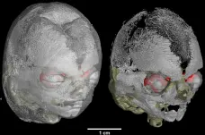 Čeští vědci vytvořili unikátní 3D atlas chrupavky lidských embryí