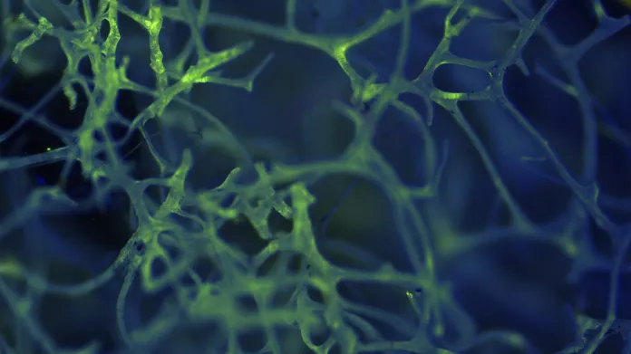 Mořská houba Porifera pod fluorescenčním mikroskopem