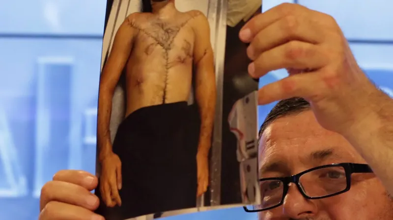 Abdulbaki Todašev ukazuje fotografie svého mrtvého syna