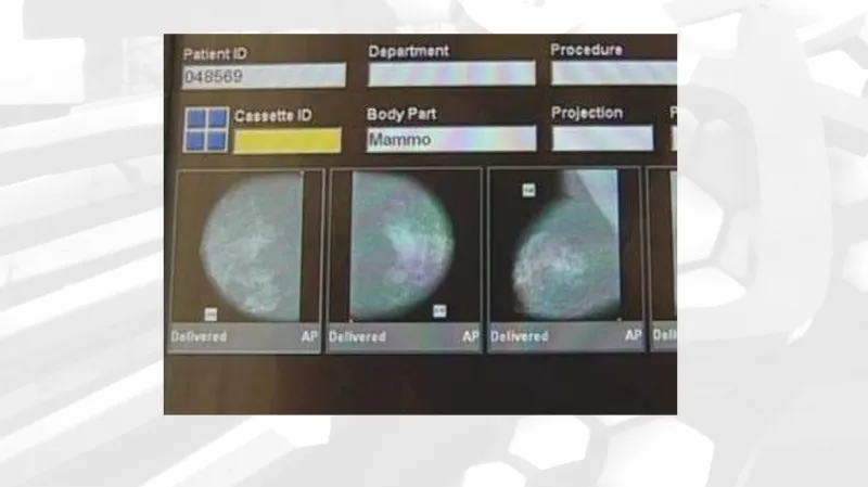 Masarykův onkologický ústav, klinika radiologie, mamografický screening