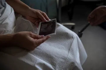 V Česku bylo provedeno nejméně potratů za posledních 65 let. Lidé těhotenství víc plánují