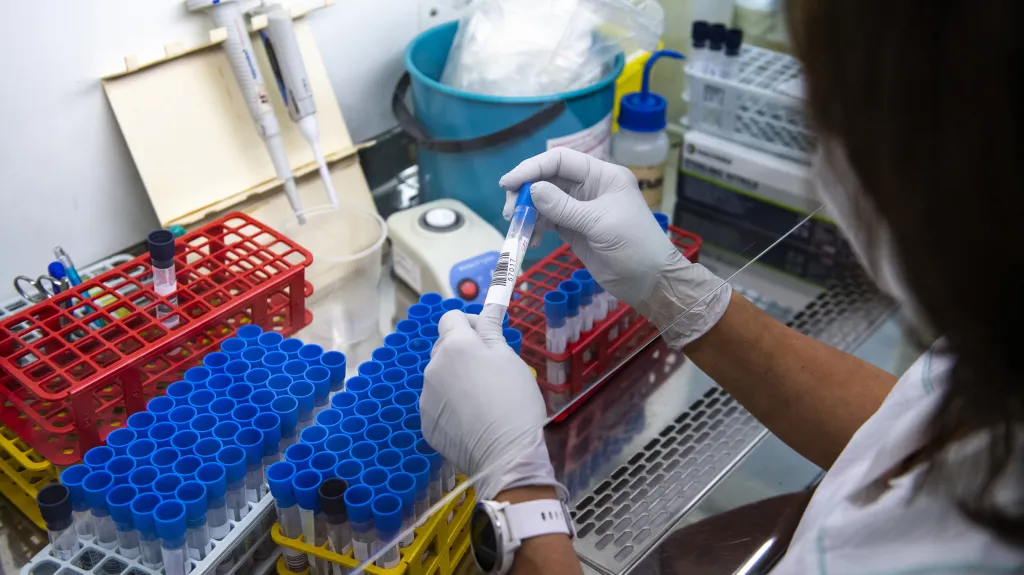 Vyhodnocování testů na covid v laboratoři trutnovské nemocnice