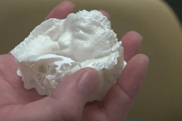Model nenarozeného dítěte podle ultrazvuku nově tisknou v nemocnici v Děčíně