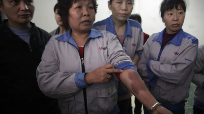 Čínské dělnice ukazují zranění po policejním zásahu