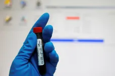 Kumpošt k ruskému dopingu: Mezinárodní olympijský výbor zvolil to nejméně špatné rozhodnutí