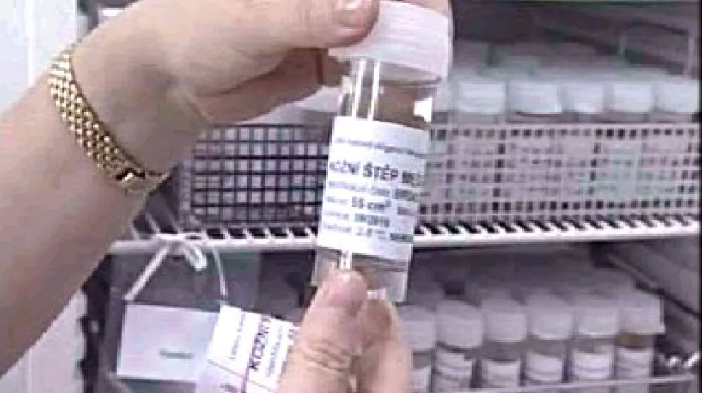 Kožní štěp v tkáňové bance