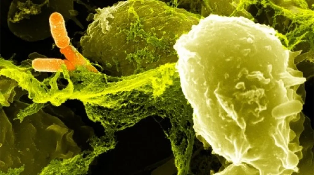 Listeria monocytogenes