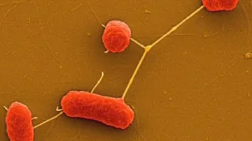 Enterohemoragická Escherichia coli