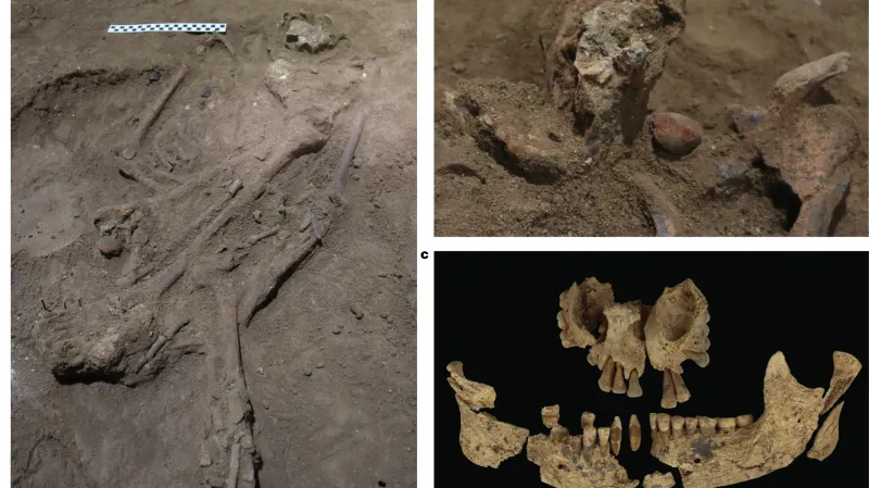 Nález nejstaršího operovaného těla