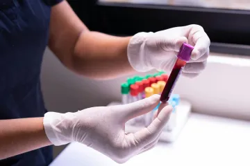 „Otékaly mi klouby, rodiče se o mě báli.“ Dnes lze hemofilii díky léčbě zvládat