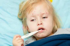 V Česku je nejvíc nemocných neštovicemi za posledních 9 let. Nejhorší situace je na Moravě