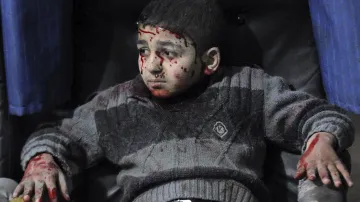 Únor 2015. Syrská občanská válka trvá už čtyři roky. Na snímku chlapec, který přežil jedno z mnoha bombardování na předměstí Damašku vojsky Bašára Asada. Od počátku konfliktu v lednu 2011 si válka vyžádala přes 250 tisíc obětí.