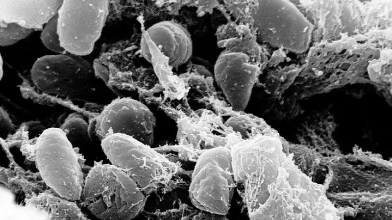 Bakterie Yersinia pestis