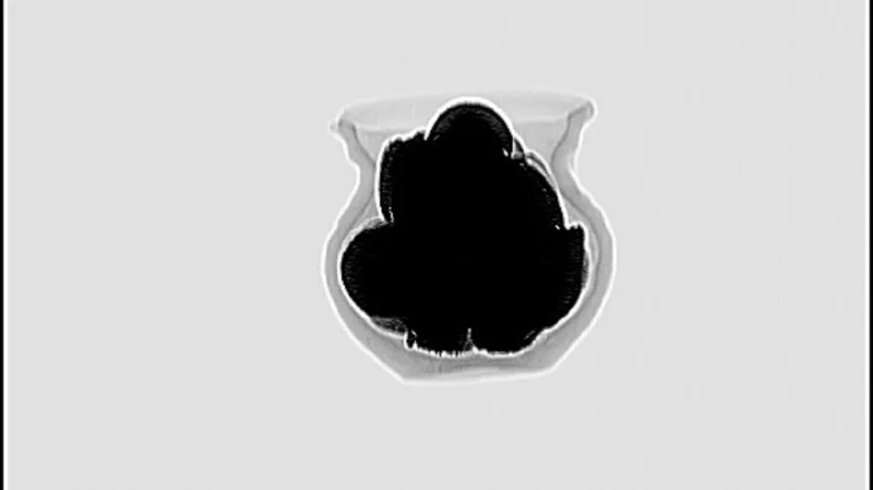 Snímek pořízený metodou CT