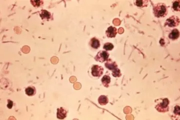 Ostravou se opět šíří úplavice