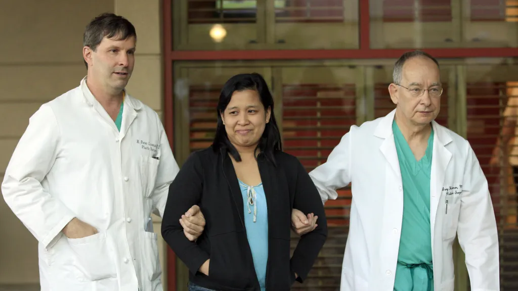 Matku siamských dvojčat přivádějí lékaři