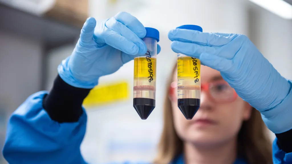 Vakcína vyvíjená Oxfordskou univerzitou a společností AstraZeneca
