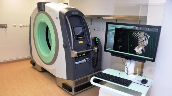 Mobilní CT scanner v liberecké nemocnici