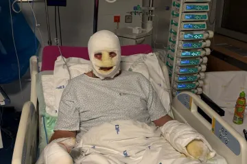 Provozovatel vypáleného zlínského baru si zachránil život, ale ne živobytí