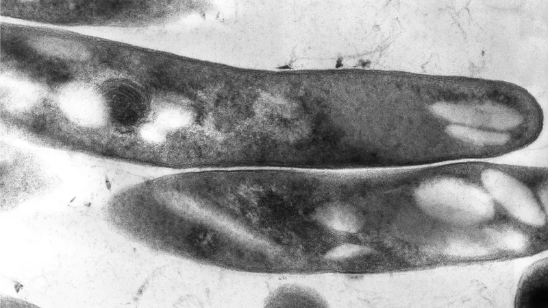 Mycobacterium tuberculosis