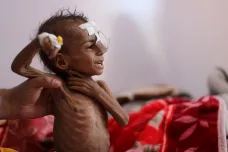 Dvěma milionům nejmenších dětí v Jemenu hrozí akutní podvýživa, upozornila OSN