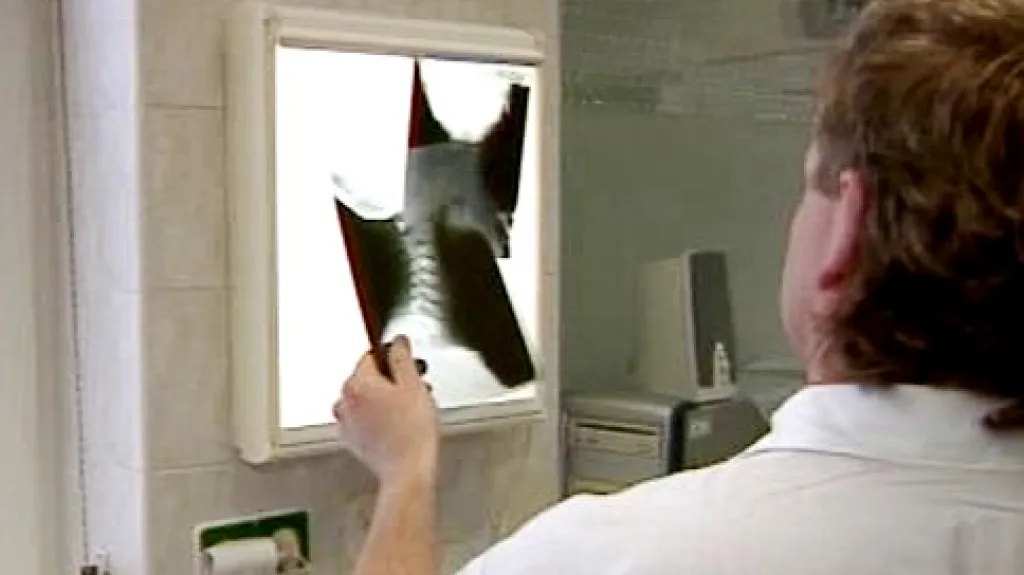 Lékař prohlíží rentgenový snímek