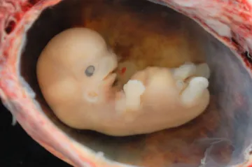 Mikroplasty pronikají až do plodové vody, prokázal ostravský výzkum