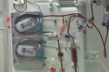 S chronickým onemocněním ledvin žije až milion Čechů