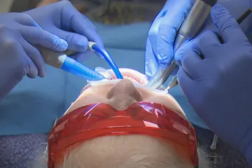 Zubaři z třetích zemí by mohli v Česku začít rychle pracovat pod dohledem kolegy. Vláda je ale zdrženlivá