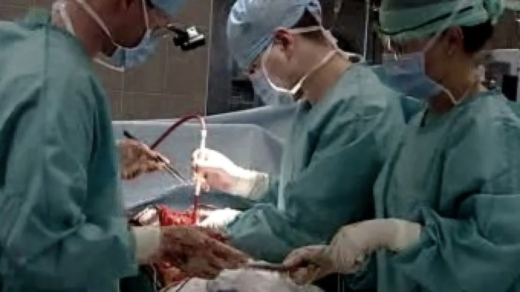 Transplantace orgánů
