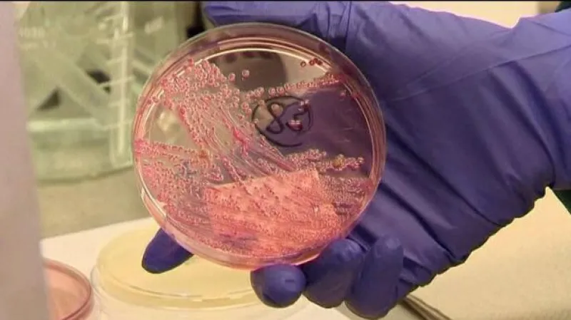 Telefonát Michala Poláška