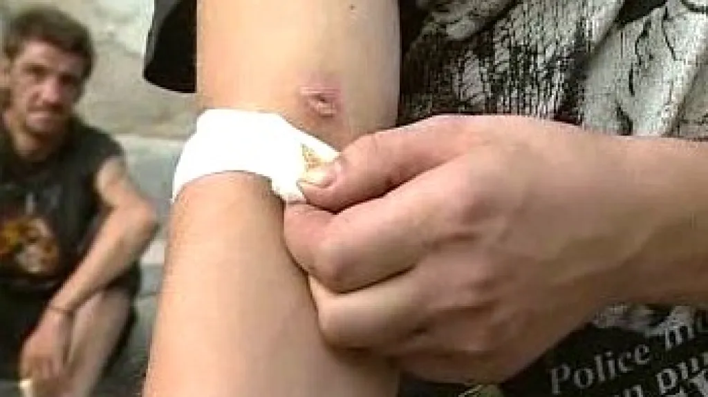 Narkoman a jeho žíla